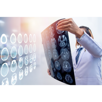 Understanding the Characteristics of Traumatic Brain Injuries Understanding the Characteristics of Traumatic Brain Injuries